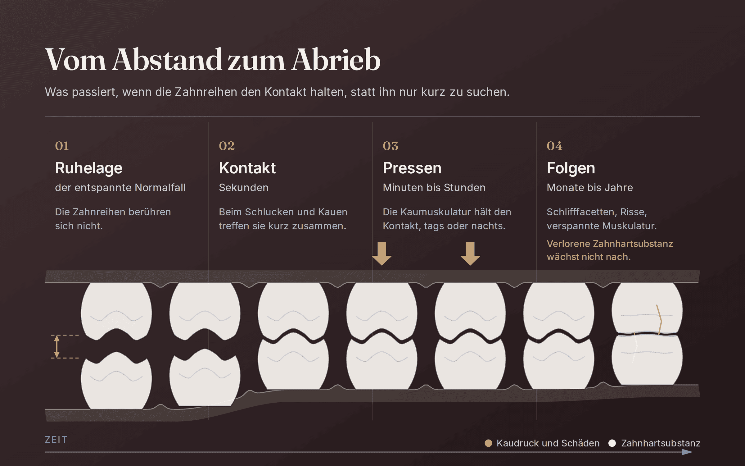 Beitragsbild: Bruxismus: Was die neue Leitlinie für Sie bedeutet